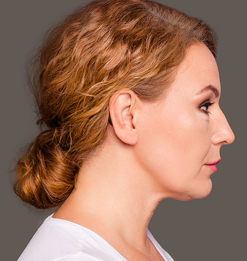 Qu’est-ce que des aides auditives mini-contours d’oreilles ?